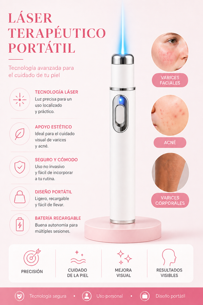 Laser Terapéutico para Várices y Acné